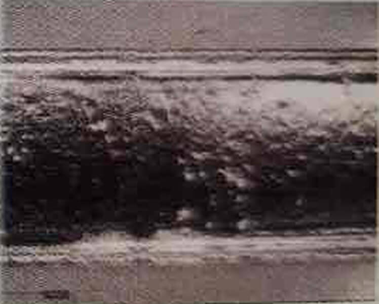 ハンディファイバー溶接のイメージ